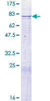ADCK4 Protein - 12.5% SDS-PAGE of human ADCK4 stained with Coomassie Blue
