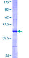ADCK4 Protein - 12.5% SDS-PAGE Stained with Coomassie Blue.