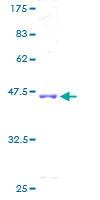 ADCK5 Protein - 12.5% SDS-PAGE of human ADCK5 stained with Coomassie Blue