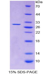 ADCY1 / Adenylate Cyclase 1 Protein - Recombinant Adenylate Cyclase 1, Brain By SDS-PAGE