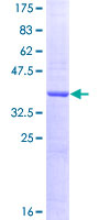 ADCY10 / Adenylate Cyclase 10 Protein - 12.5% SDS-PAGE Stained with Coomassie Blue.