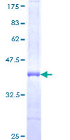 ADCY2 / Adenylate Cyclase 2 Protein - 12.5% SDS-PAGE Stained with Coomassie Blue.
