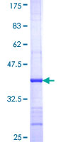 ADCY3 / Adenylate Cyclase 3 Protein - 12.5% SDS-PAGE Stained with Coomassie Blue.