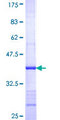 ADCY3 / Adenylate Cyclase 3 Protein - 12.5% SDS-PAGE Stained with Coomassie Blue.