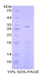 ADCY3 / Adenylate Cyclase 3 Protein - Recombinant Adenylate Cyclase 3 By SDS-PAGE