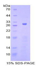 ADCY5 / Adenylate Cyclase 5 Protein - Recombinant Adenylate Cyclase 5 By SDS-PAGE