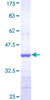 ADCY5 / Adenylate Cyclase 5 Protein - 12.5% SDS-PAGE Stained with Coomassie Blue.