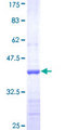 ADCY5 / Adenylate Cyclase 5 Protein - 12.5% SDS-PAGE Stained with Coomassie Blue.