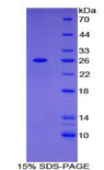 ADCY6 / Adenylate Cyclase 6 Protein - Recombinant Adenylate Cyclase 6 By SDS-PAGE