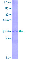 ADCY6 / Adenylate Cyclase 6 Protein - 12.5% SDS-PAGE Stained with Coomassie Blue.