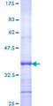 ADCY7 / Adenylate Cyclase 7 Protein - 12.5% SDS-PAGE Stained with Coomassie Blue.