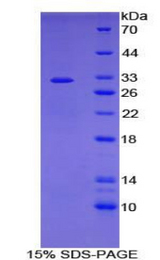 ADCY7 / Adenylate Cyclase 7 Protein - Recombinant Adenylate Cyclase 7 By SDS-PAGE