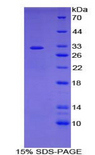 ADCY7 / Adenylate Cyclase 7 Protein - Recombinant Adenylate Cyclase 7 By SDS-PAGE
