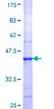ADCY8 / Adenylate Cyclase 8 Protein - 12.5% SDS-PAGE Stained with Coomassie Blue.