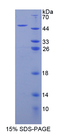 ADCY8 / Adenylate Cyclase 8 Protein - Recombinant  Adenylate Cyclase 8, Brain By SDS-PAGE