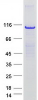 ADD1 / Adducin Alpha Protein - Purified recombinant protein ADD1 was analyzed by SDS-PAGE gel and Coomassie Blue Staining