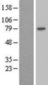 ADD2 Protein - Western validation with an anti-DDK antibody * L: Control HEK293 lysate R: Over-expression lysate