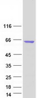 ADD2 Protein - Purified recombinant protein ADD2 was analyzed by SDS-PAGE gel and Coomassie Blue Staining