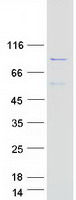 ADD2 Protein - Purified recombinant protein ADD2 was analyzed by SDS-PAGE gel and Coomassie Blue Staining