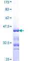 ADD3 Protein - 12.5% SDS-PAGE Stained with Coomassie Blue.