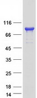 ADD3 Protein - Purified recombinant protein ADD3 was analyzed by SDS-PAGE gel and Coomassie Blue Staining