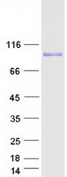 ADD3 Protein - Purified recombinant protein ADD3 was analyzed by SDS-PAGE gel and Coomassie Blue Staining