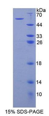 ADGRB3 / BAI3 Protein - Recombinant Brain Specific Angiogenesis Inhibitor 3 By SDS-PAGE
