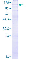 ADGRE1 / EMR1 Protein - 12.5% SDS-PAGE of human EMR1 stained with Coomassie Blue