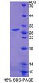 ADGRE1 / EMR1 Protein - Recombinant EGF Like Module Containing Mucin Like Hormone Receptor 1 By SDS-PAGE