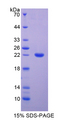 ADGRE2 / EMR2 Protein - Recombinant  EGF Like Module Containing Mucin Like Hormone Receptor 2 By SDS-PAGE