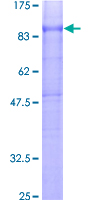 ADGRE5 / CD97 Protein - 12.5% SDS-PAGE of human CD97 stained with Coomassie Blue