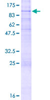 ADGRE5 / CD97 Protein - 12.5% SDS-PAGE of human CD97 stained with Coomassie Blue