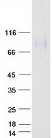 ADGRE5 / CD97 Protein - Purified recombinant protein ADGRE5 was analyzed by SDS-PAGE gel and Coomassie Blue Staining