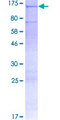 ADGRF3 / GPR113 Protein - 12.5% SDS-PAGE of human GPR113 stained with Coomassie Blue