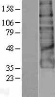 ADGRG1 / GPR56 Protein - Western validation with an anti-DDK antibody * L: Control HEK293 lysate R: Over-expression lysate