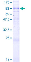 ADGRG1 / GPR56 Protein - 12.5% SDS-PAGE of human GPR56 stained with Coomassie Blue