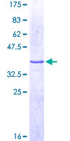 ADGRG1 / GPR56 Protein - 12.5% SDS-PAGE Stained with Coomassie Blue.