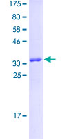 ADGRG7 / GPR128 Protein - 12.5% SDS-PAGE Stained with Coomassie Blue.