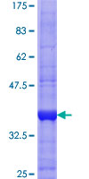 ADGRL1 / LPHN1 Protein - 12.5% SDS-PAGE Stained with Coomassie Blue.