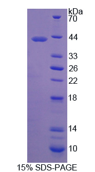 ADGRL3 / LPHN3 Protein - Recombinant Latrophilin 3 By SDS-PAGE