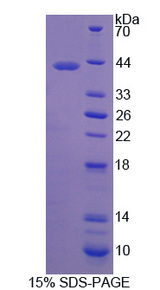 ADGRL3 / LPHN3 Protein - Recombinant Latrophilin 3 By SDS-PAGE
