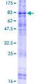 ADGRL4 / ELTD1 Protein - 12.5% SDS-PAGE of human ELTD1 stained with Coomassie Blue