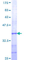 ADGRL4 / ELTD1 Protein