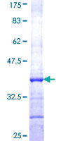 ADH1A / Alcohol Dehydrogenase Protein - 12.5% SDS-PAGE Stained with Coomassie Blue.