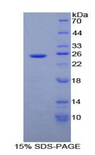 ADH1A / Alcohol Dehydrogenase Protein - Recombinant Alcohol Dehydrogenase 1 By SDS-PAGE