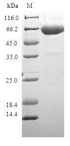 ADH1C Protein - (Tris-Glycine gel) Discontinuous SDS-PAGE (reduced) with 5% enrichment gel and 15% separation gel.