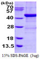 ADH1C Protein
