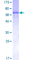 ADH4 Protein - 12.5% SDS-PAGE of human ADH4 stained with Coomassie Blue