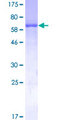 ADH4 Protein - 12.5% SDS-PAGE of human ADH4 stained with Coomassie Blue