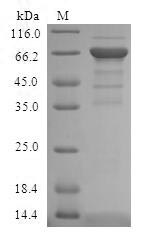 ADH4 Protein - (Tris-Glycine gel) Discontinuous SDS-PAGE (reduced) with 5% enrichment gel and 15% separation gel.